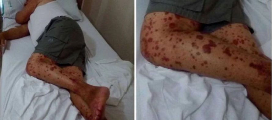 Murió tras ser rociado con agroquímicos en el patio de su casa
