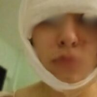 Se recupera la menor salvajemente agredida en San Cristóbal